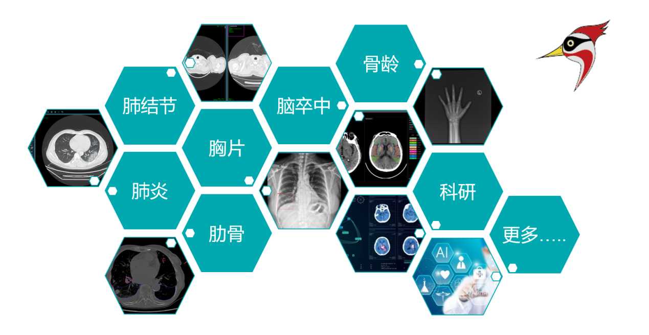 AI影像辅助云诊断解决计划